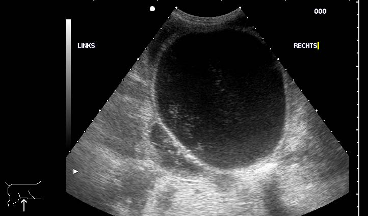 Ultraschallbild einer Harnblase