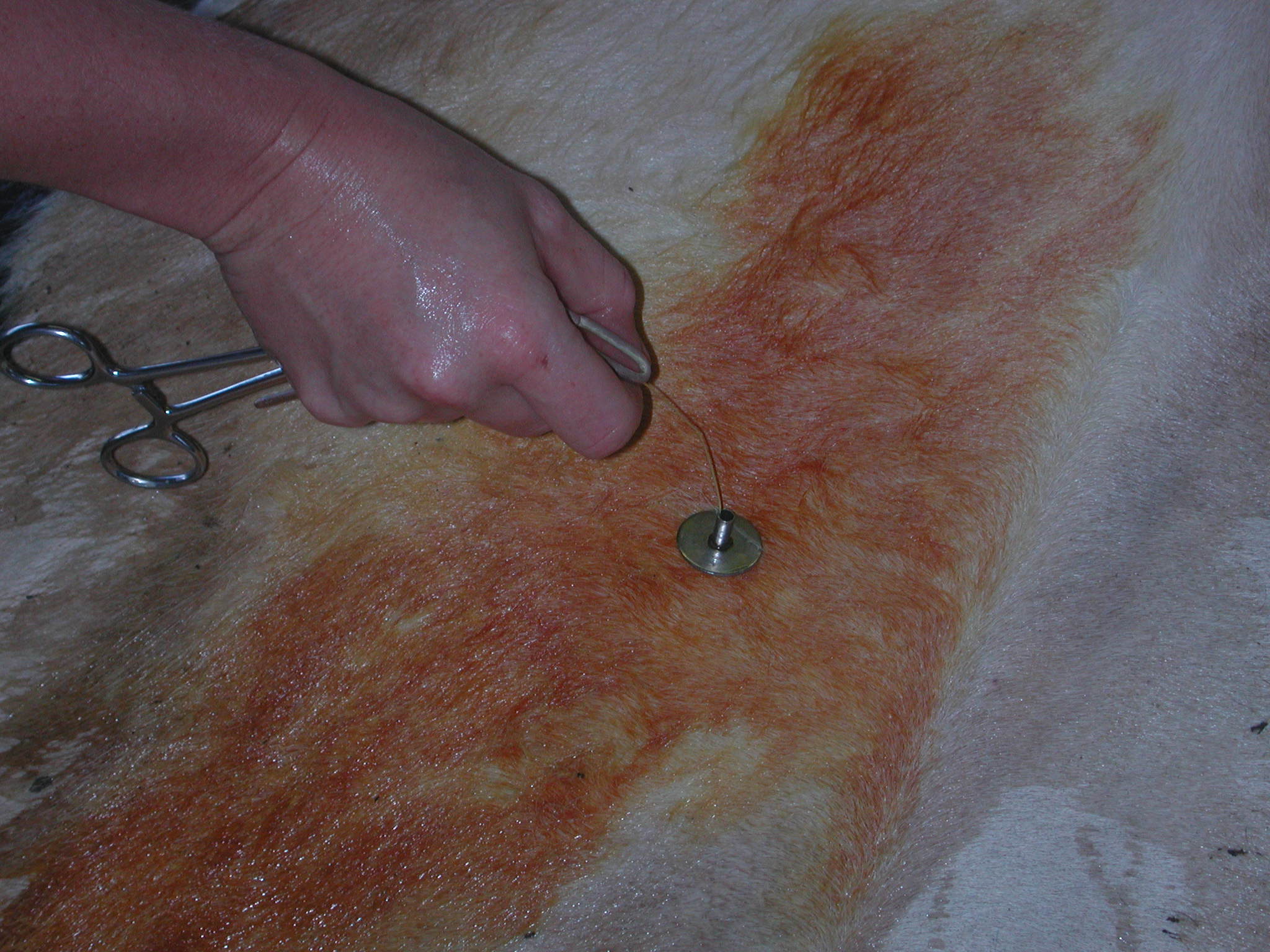 Toggle und Suture Methode