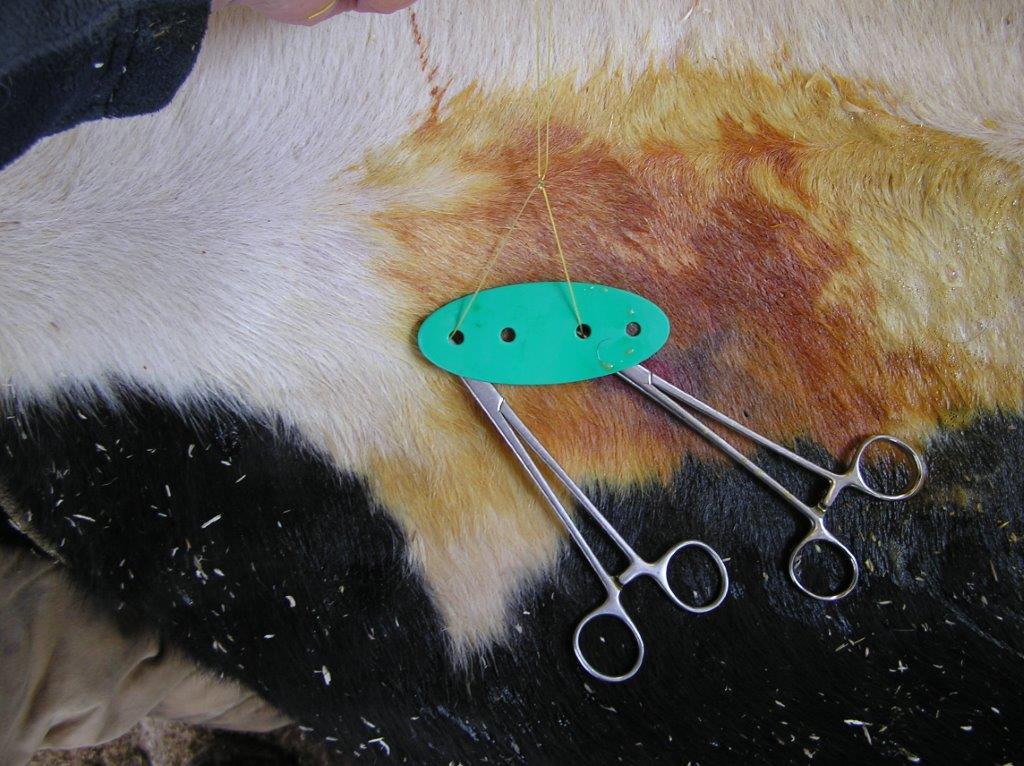 Toggle und Suture Methode