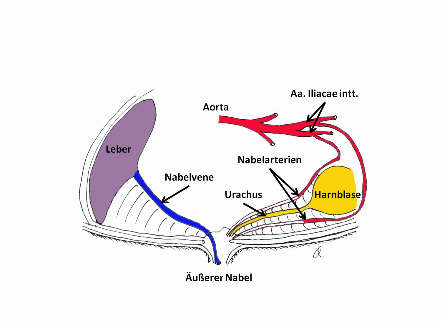 Palpation der kaudalen Nabelstrukturen